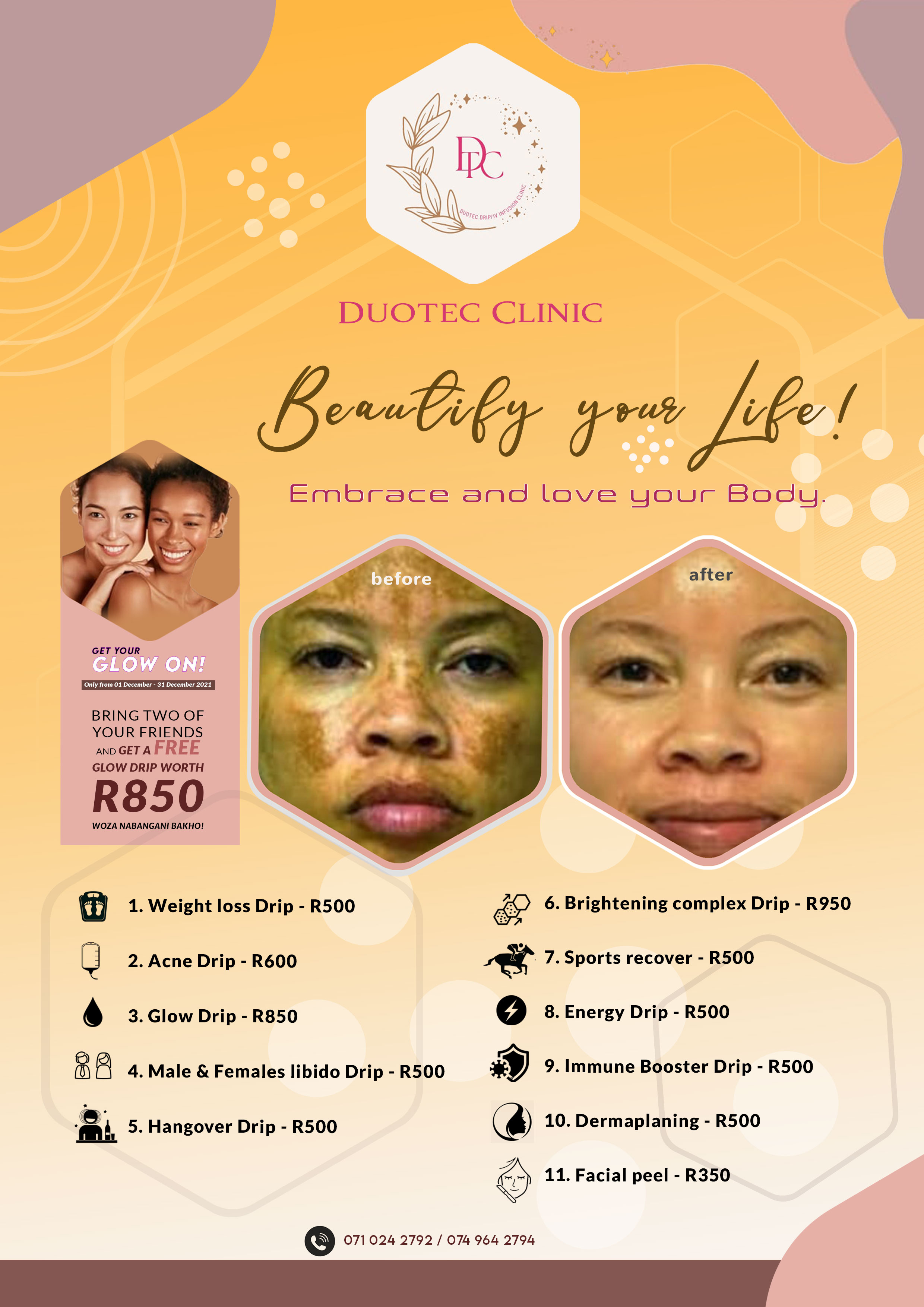Advert 1